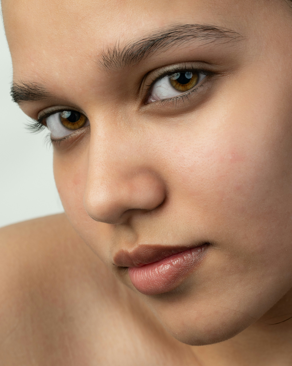 Skin Coach™ Acne Spot Care